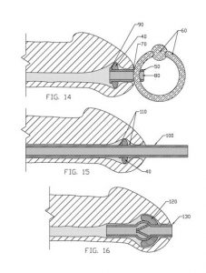 Urethral Play Diagram